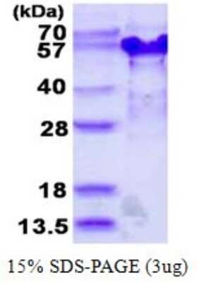 SDS-PAGE: Recombinant Human TSSC4 His Protein [NBP1-78869]