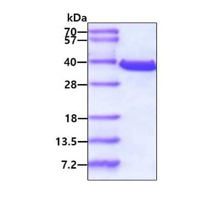 SDS-PAGE: Recombinant Human TST His (N-Term) Protein [NBP1-30286]