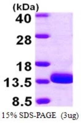 SDS-PAGE: Recombinant Human TSTD1 His Protein [NBP1-78798]