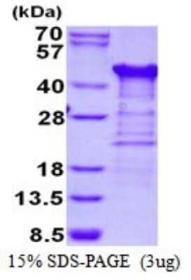 SDS-PAGE: Recombinant Human TTC1 His Protein [NBP1-98891]