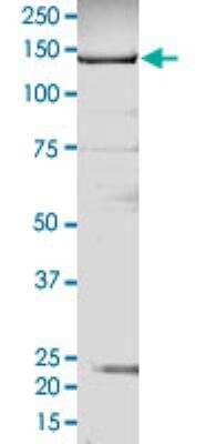 SDS-PAGE: Recombinant Human TTK His-GST Protein [P4790]