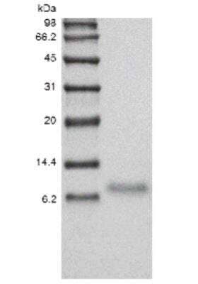 SDS-PAGE: Recombinant Human TWEAK R/TNFRSF12 Protein [NBP2-35085]