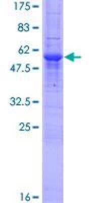 SDS-PAGE: Recombinant Human TXNDC GST (N-Term) Protein [H00081542-P01]