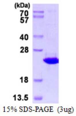 SDS-PAGE: Recombinant Human TXNDC12 His Protein [NBP1-98938]