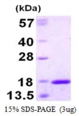 SDS-PAGE: Recombinant Human TXNL4A His Protein [NBP1-98988]