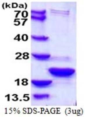 SDS-PAGE: Recombinant Human TXNL4B His Protein [NBP1-72336]