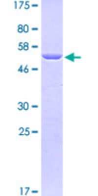 SDS-PAGE: Recombinant Human Talin1 GST (N-Term) Protein [H00007094-Q08]