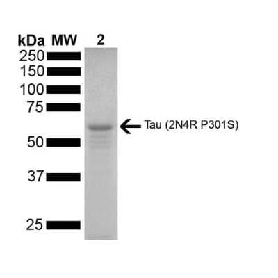 SDS-PAGE: Recombinant Human Tau 441 Active, Monomer, P301S Mutant Protein [NBP2-76795]