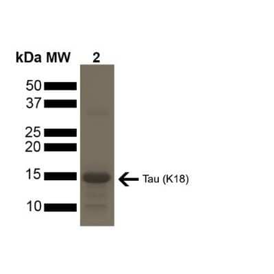 SDS-PAGE: Recombinant Human Tau Active, (K18), P301L Mutant, Pre-formed Fibrils Protein [NBP2-76793]