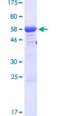 SDS-PAGE: Recombinant Human Tesmin GST (N-Term) Protein [H00009633-P01]