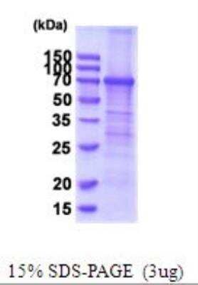 SDS-PAGE: Recombinant Human TfR (Transferrin R) His Protein [NBP2-51991]