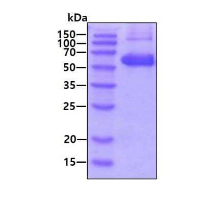 SDS-PAGE: Recombinant Human Thioredoxin Reductase 1/TRXR1 His Protein [NBP1-44456]