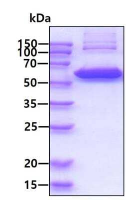 SDS-PAGE: Recombinant Human Thioredoxin Reductase 1/TRXR1 His Protein [NBP1-50928]