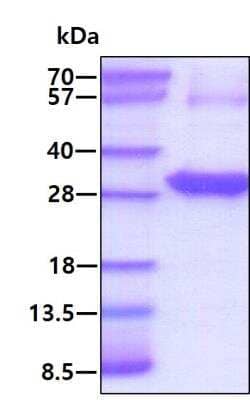 SDS-PAGE: Recombinant Human Thymidine Kinase 1 His Protein [NBP1-98920]