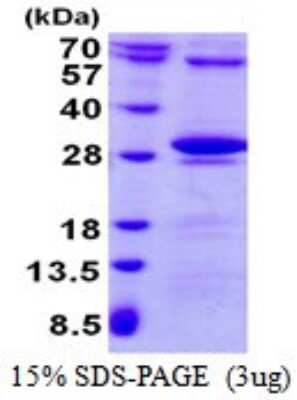 SDS-PAGE: Recombinant Human Thymidine Kinase 2 His Protein [NBP1-98864]