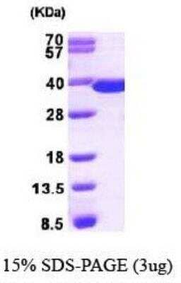 SDS-PAGE: Recombinant Human Thymidylate Synthase His Protein [NBP1-30310]