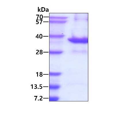 SDS-PAGE: Recombinant Human Tollip His Protein [NBP1-72313]