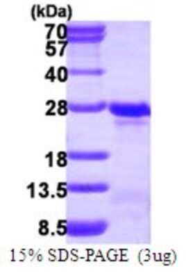 SDS-PAGE: Recombinant Human Transgelin-3 His Protein [NBP1-72475]