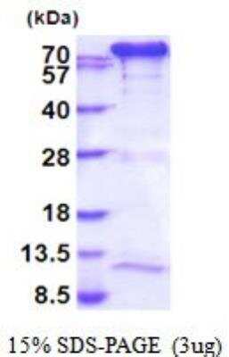 SDS-PAGE: Recombinant Human Transglutaminase 2/TGM2 His Protein [NBP2-52009]