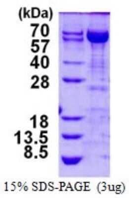 SDS-PAGE: Recombinant Human Transketolase His Protein [NBP1-99073]