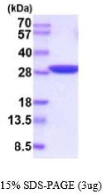 SDS-PAGE: Recombinant Human Triosephosphate isomerase His Protein [NBP2-53086]