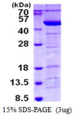 SDS-PAGE: Recombinant Human Tropomodulin 3 His Protein [NBP1-98885]