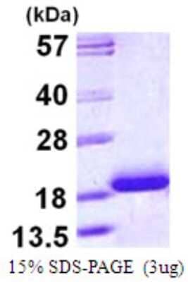 SDS-PAGE: Recombinant Human Troponin C (cardiac) His Protein [NBP1-72499]