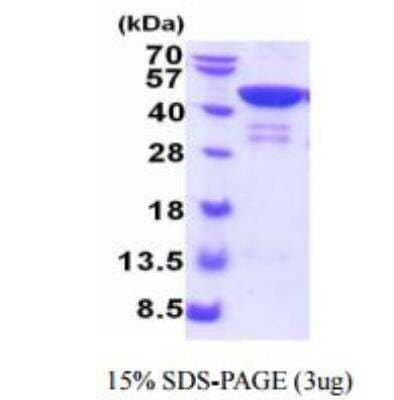 SDS-PAGE: Recombinant Human Troponin T Type 2 (cardiac) His Protein [NBC1-28765]