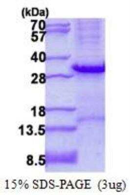 SDS-PAGE: Recombinant Human Tryptase beta-2/TPSB2 His Protein [NBP2-22894]