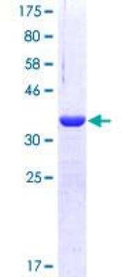 SDS-PAGE: Recombinant Human Tyk2 GST (N-Term) Protein [H00007297-Q01]