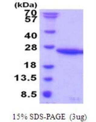 SDS-PAGE: Recombinant Human UBE2G1 His Protein [NBP2-51899]