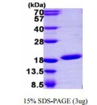 SDS-PAGE: Recombinant Human UBE2N/Ubc13 His Protein [NBP1-51063]