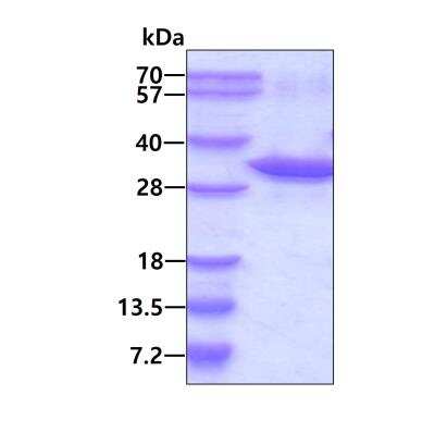 SDS-PAGE: Recombinant Human UBE2Z His Protein [NBP2-51738]