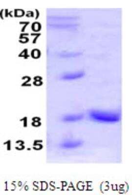 SDS-PAGE: Recombinant Human UBL4A His Protein [NBP1-99099]