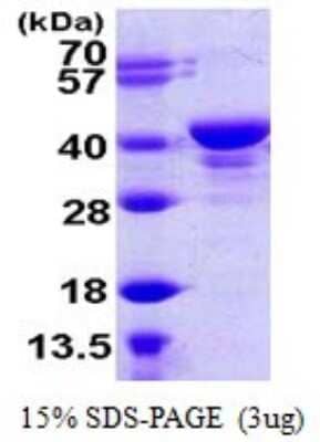 SDS-PAGE: Recombinant Human UCH-L5/UCH37 His Protein [NBP1-72315]