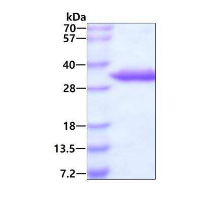 SDS-PAGE: Recombinant Human UCK2 His Protein [NBP1-50888]