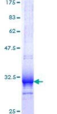 SDS-PAGE: Recombinant Human UCP1 GST (N-Term) Protein [H00007350-Q01]