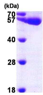 SDS-PAGE: Recombinant Human UDP glucose dehydrogenase His Protein [NBP1-45276]