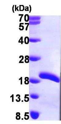 SDS-PAGE: Recombinant Human UEV2 His Protein [NBP1-45295]