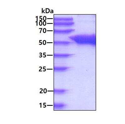 SDS-PAGE: Recombinant Human UGP2 His Protein [NBP2-51875]