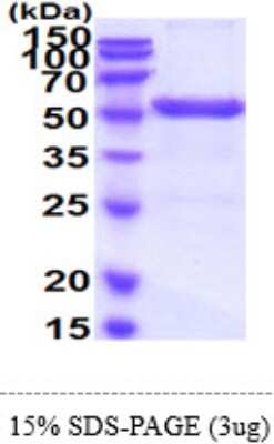 SDS-PAGE: Recombinant Human UMPS His Protein [NBP2-60213]