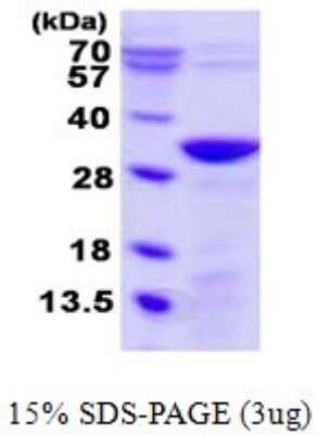 SDS-PAGE: Recombinant Human UNC119B His Protein [NBP1-78897]