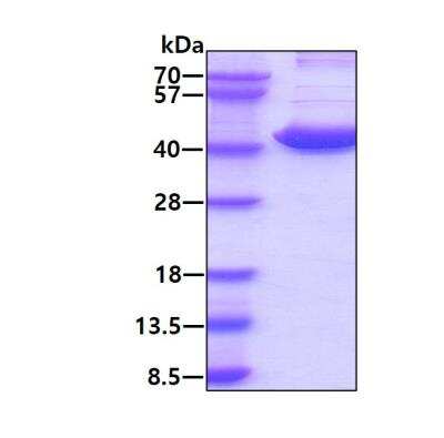 SDS-PAGE: Recombinant Human UROD His Protein [NBP1-45277]