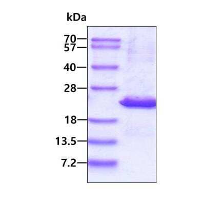 SDS-PAGE: Recombinant Human UXT His Protein [NBP2-22926]