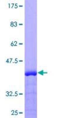 SDS-PAGE: Recombinant Human Uromodulin GST (N-Term) Protein [H00007369-Q01]