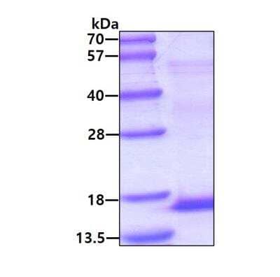 SDS-PAGE: Recombinant Human Uroplakin II His Protein [NBP2-22935]