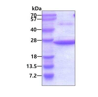 SDS-PAGE: Recombinant Human Uroplakin III His Protein [NBP1-72543]