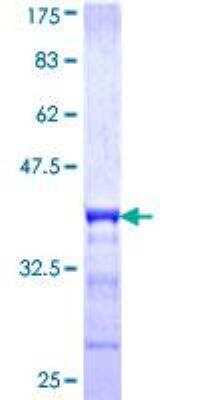 SDS-PAGE: Recombinant Human Uroplakin Ib GST (N-Term) Protein [H00007348-Q01]