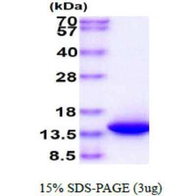 SDS-PAGE: Recombinant Human VAMP-1 His Protein [NBC1-18336]