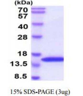 SDS-PAGE: Recombinant Human VAMP-2 His Protein [NBC1-18335]